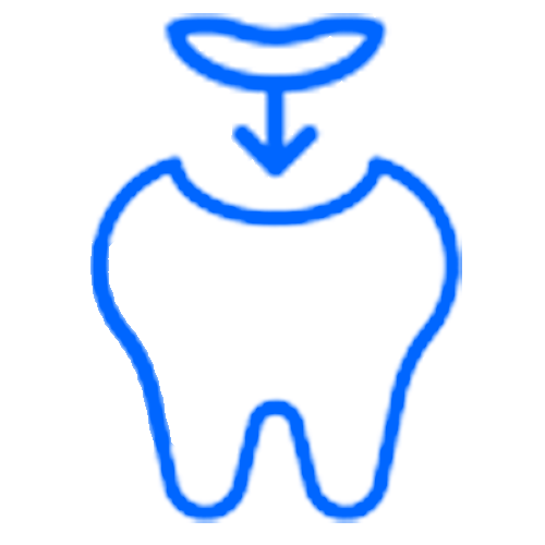 Dental fillings and restorations  