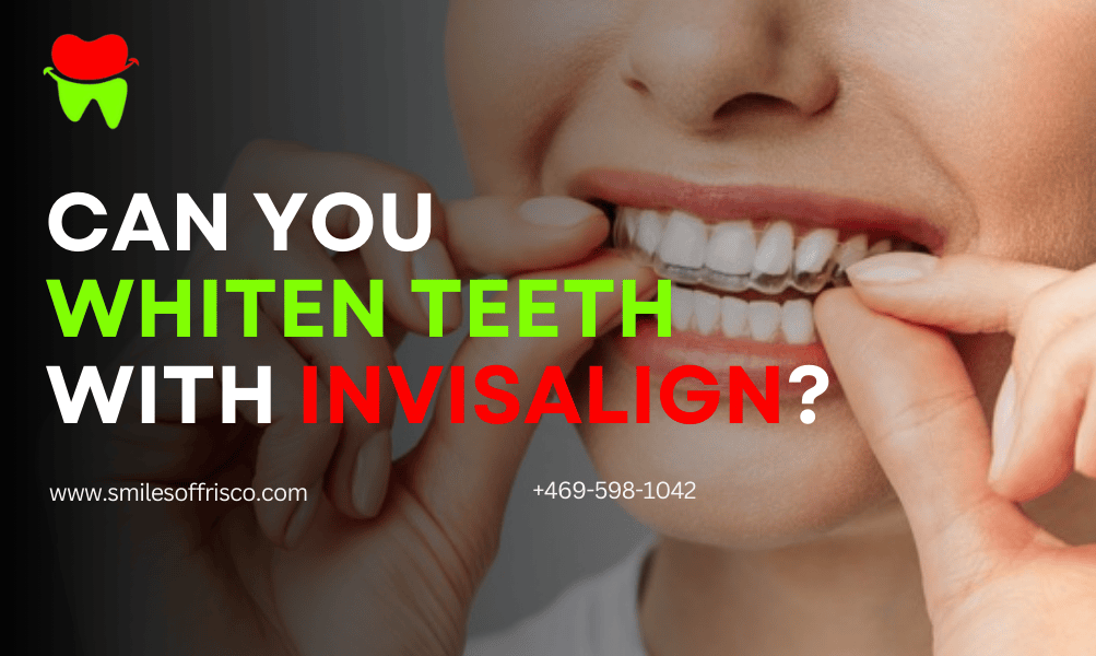 Invisalign Teeth whitening