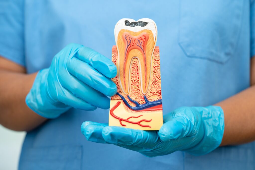 root canal treatment in frisco, best dental clinic in frisco, affordable root canal treatment, telugu speaking dentist in frisco
